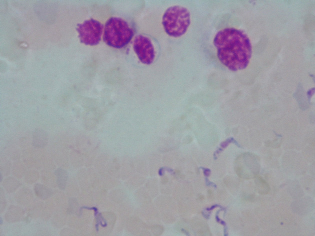 Trypanosoma Slides - Trypanosoma 05 400X